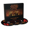 KING DIAMOND - Songs For The Dead Live - 2DVD+CD